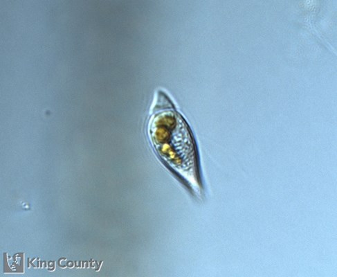 Photo of Amphidinium sphenoides
